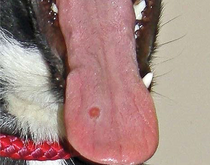 Tongue lesions