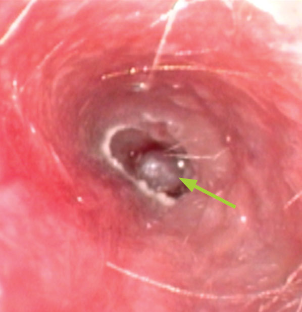 Figure 4: View down the ear canal of a dog with a tumour visible in the distance (arrowed)