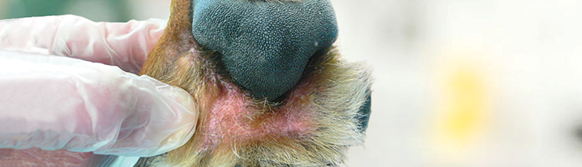 Malassezia Dermatitis Malassezia Dermatitis