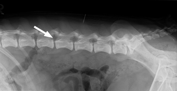 A normal X-ray of the spine – the bones are clearly visible, but the area of the spinal cord (arrow) shows no soft tissue detail