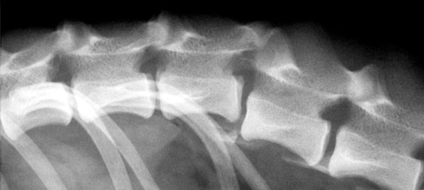 Luxated (dislocated) vertebrae in the back that have been stabilised with a plate and four screws