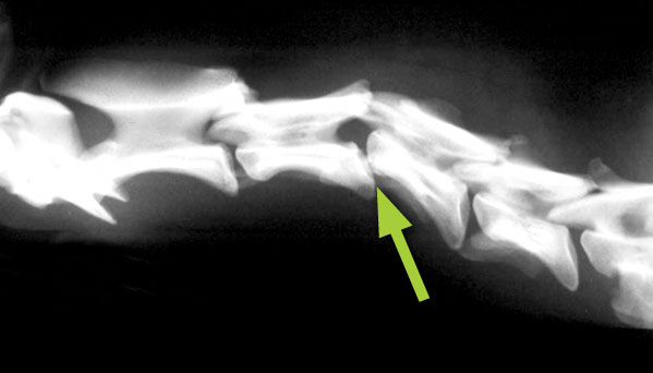 X-ray of the neck showing luxated (dislocated) vertebrae (arrow)