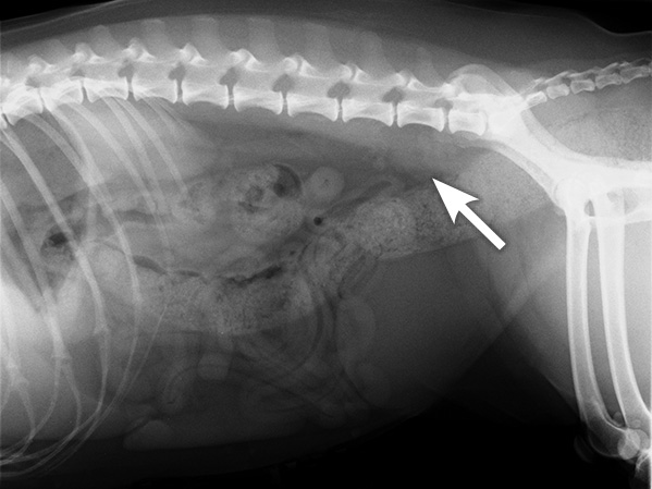 X-ray of a patient with mildly enlarged lymph nodes under the spine (arrow)