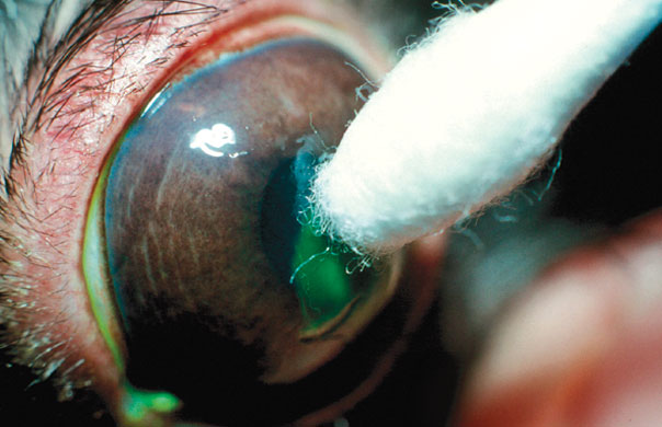 A rabbit’s cornea undergoing debridement under topical anaesthesia