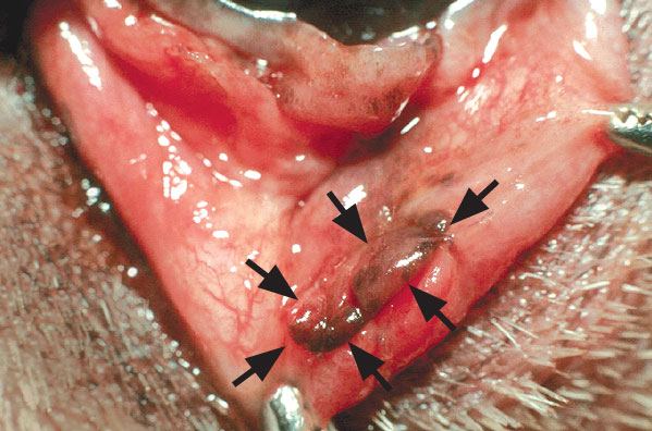 The opening of the parotid duct (arrowed) has been stitched into the pocket below the eye using very fine sutures