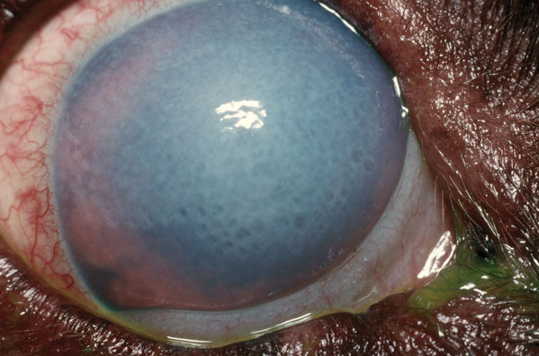 An eye which has healed after thermokeratoplasty