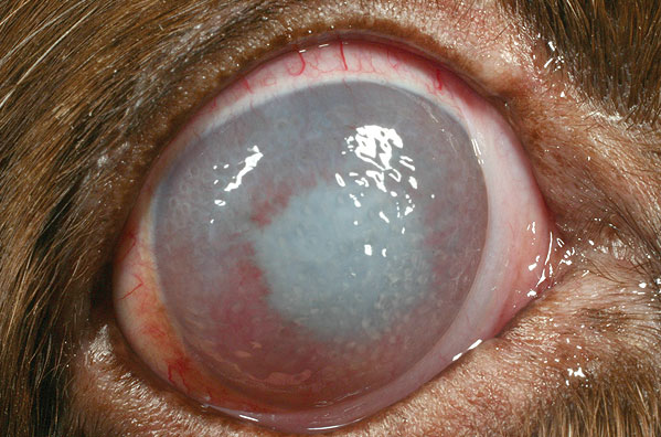 An eye which has had thermokeratoplasty performed ten days earlier. The angry appearance will fade over the next few weeks. The eye is already comfortable.