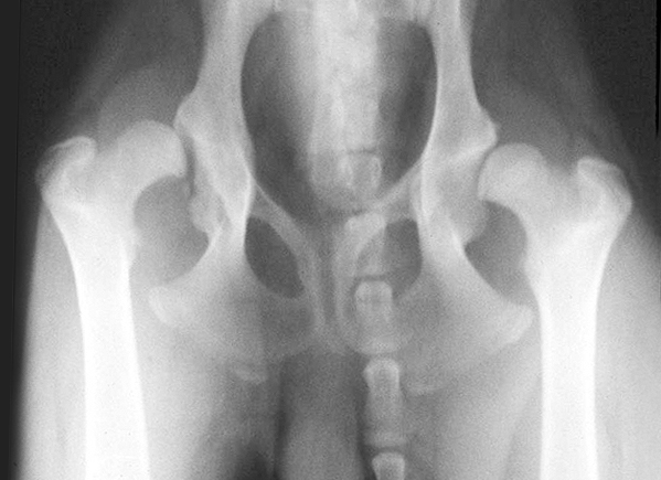 X-ray showing severe hip dysplasia