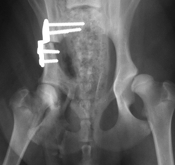 X-ray showing triple pelvic osteotomy