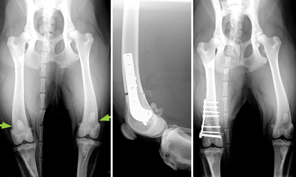 This Golden Retriever has deformity of both hind limbs with a resulting ‘bow-legged’ appearance (arrows). The more severely deformed femur (thigh bone) has been cut, straightened and stabilised with a special curved plate.