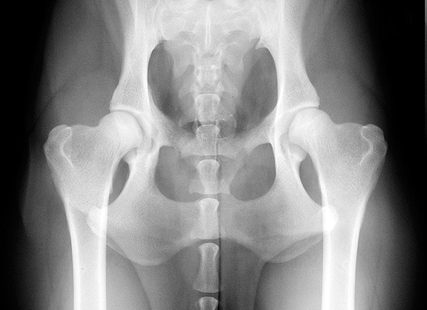 Radiograph showing normal hip joints