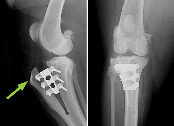 X-rays showing implants following TTA surgery with advancement of the tibial tuberosity (arrow) 
