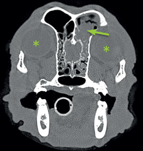 Figure 3: This is a computed tomography (CT) image of a cross section of a dog’s nose at the level of the frontal sinuses. The eyes can be seen as circular areas (the eyes have been marked with asterisks). The frontal sinuses are normally air-filled spaces within the skull, just above and behind the eyes. In this image, the dog’s left frontal sinus (arrowed) has become almost completely filled with fungal growth (Aspergillus). Air is seen as black on the scan.