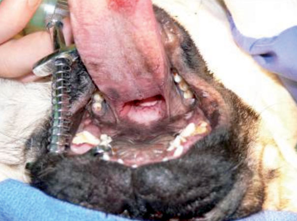 After surgery to shorten the soft palate