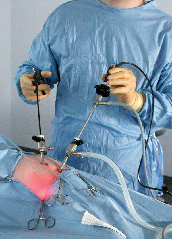 An ovariectomy procedure