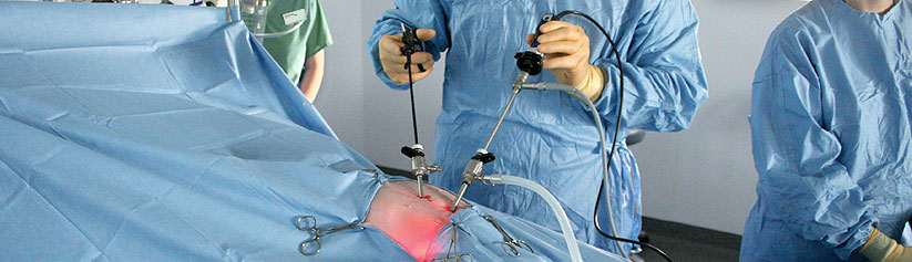 Laparoscopic ovariectomy (Keyhole spay)