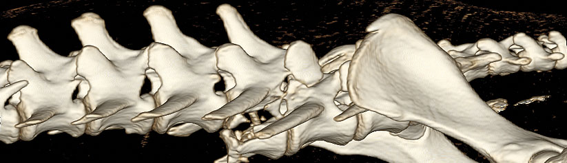 pg-hdr-cervical-spinal-fractures