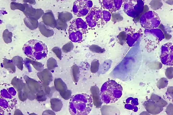cytology-a-useful-tool-in-dermatology-consults-web