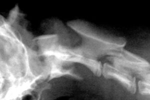Canine atlantoxial instability radiograph image