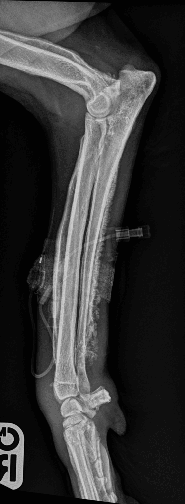 sybil xray 1
