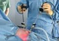 pg-hdr-laparoscopic-ovariectomy-keyhole-surgery-spay
